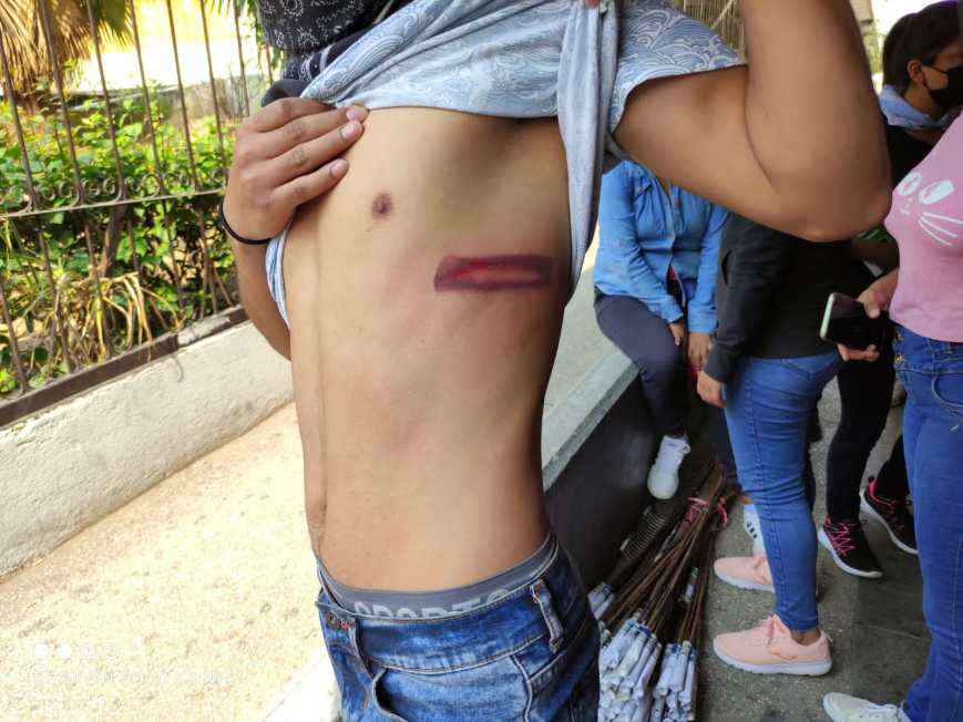 Chiapas: Alto a la represión a los profesores de telebachillerato